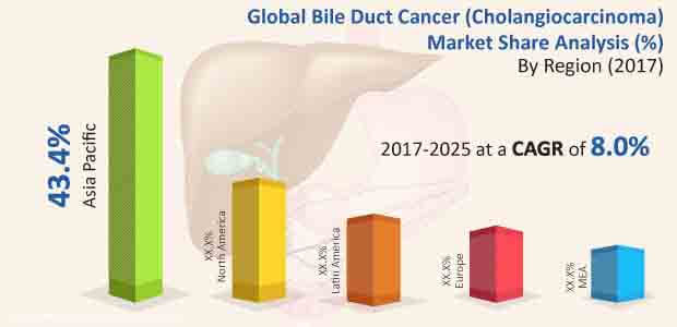 胆管癌治疗市场