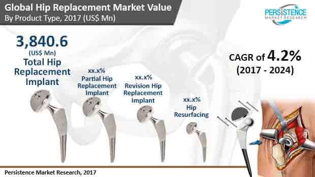 hip-replacement-market.jpg