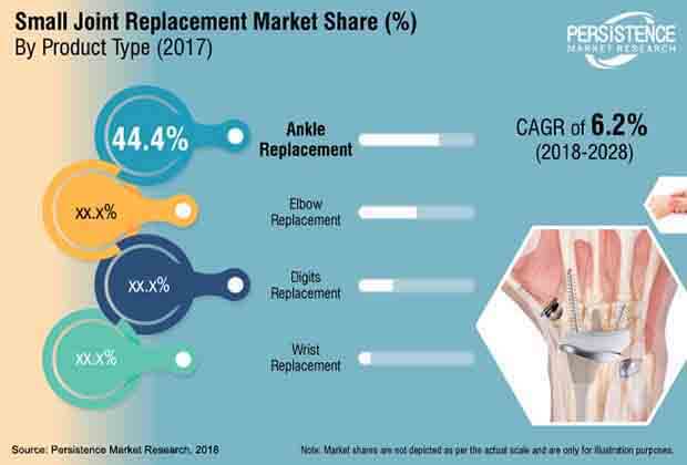 small-joint-replacement-market.jpg